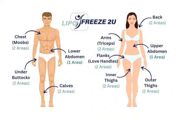 Areas you can have fat freezing treatment Buxton