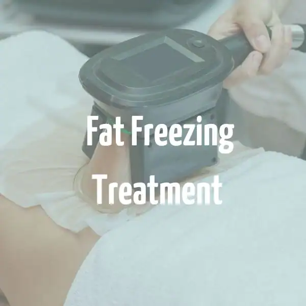 fat freezing treatment Buxton