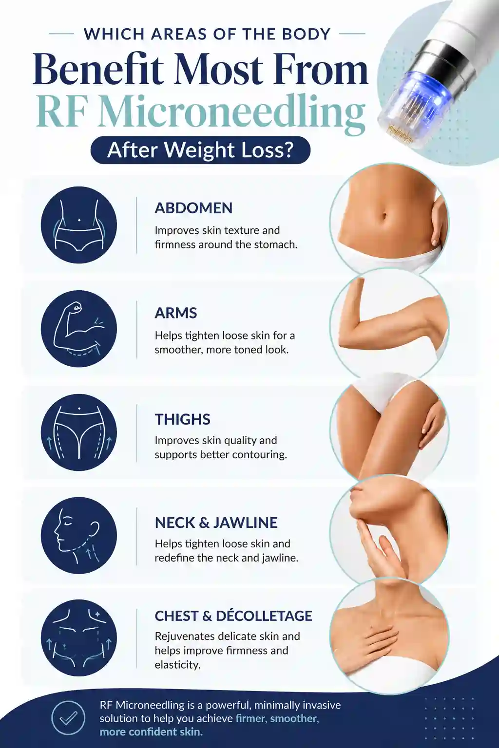 Which Areas of the Body Benefit Most From RF Microneedling After Weight Loss Buxton